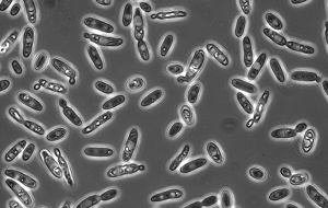 Brettanomyces yeast cells through a microscope. (Photo: The Brettanomyces Project)